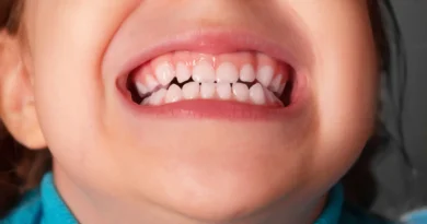 Cuidar dos Dentes de Leite