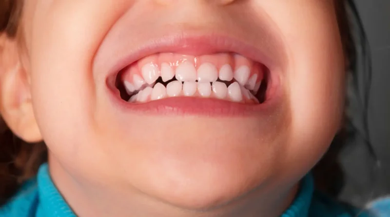 Cuidar dos Dentes de Leite