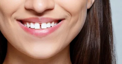 Espaço Entre os Dentes